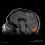 Brain Surgery